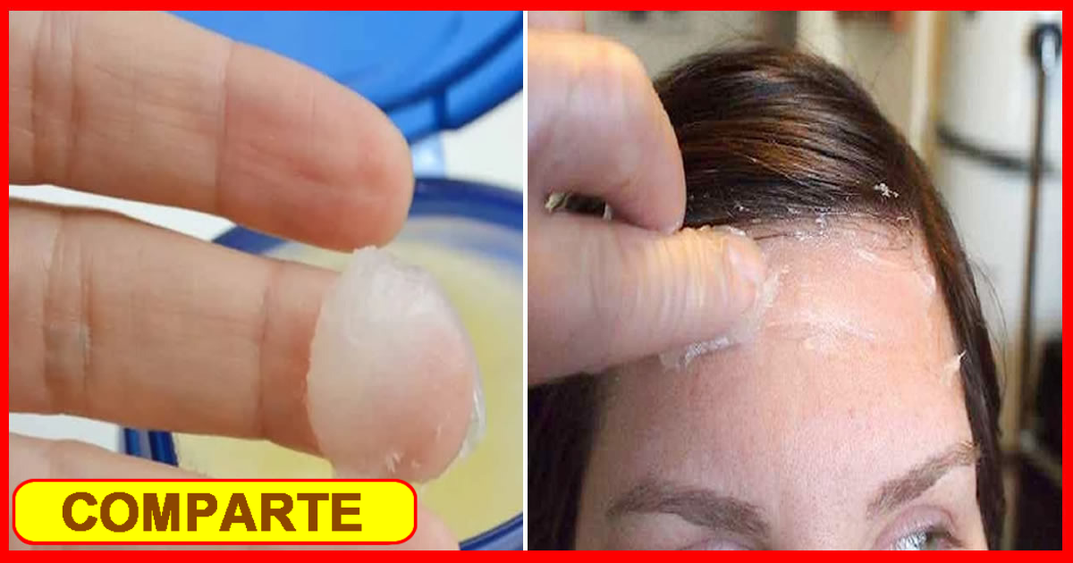 3 formas de eliminar manchas de tinte de cabello de tu piel